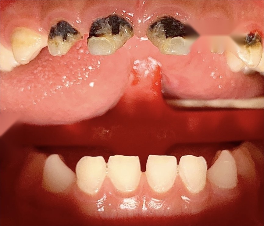 Before treatment